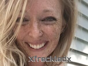 Xfreckledx